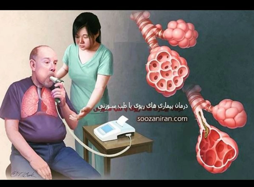 The Connection Between Chronic Obstructive Pulmonary Disease and Respiratory Infections