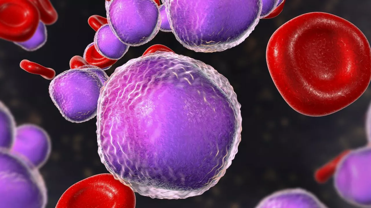 The Importance of Regular Check-Ups for Chromosome-Positive Lymphoblastic Leukemia Patients